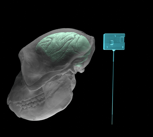 deep array no neuropixel