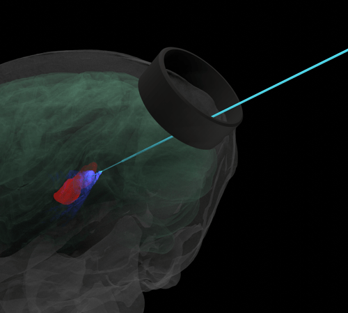 deep array optogenetics aspect ratio 2