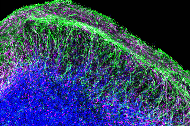 asd-brain-organoid-neurosicneces