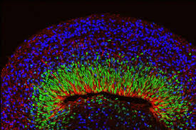 organoid - fluorescent